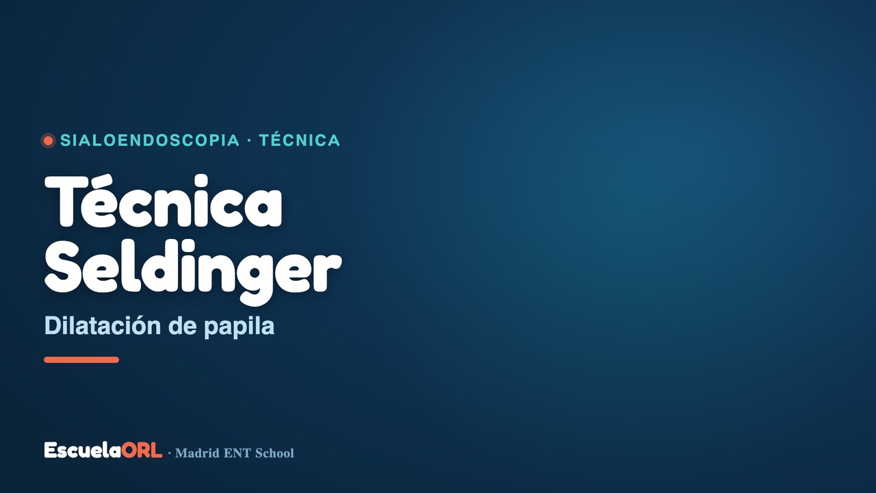 Miniatura del vídeo Dilatación de papila previa a sialoendoscopia (Técnica Seldinger)