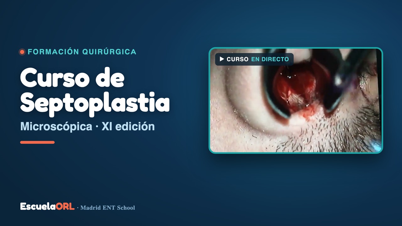 Miniatura del vídeo Curso Septoplastia XI edicion