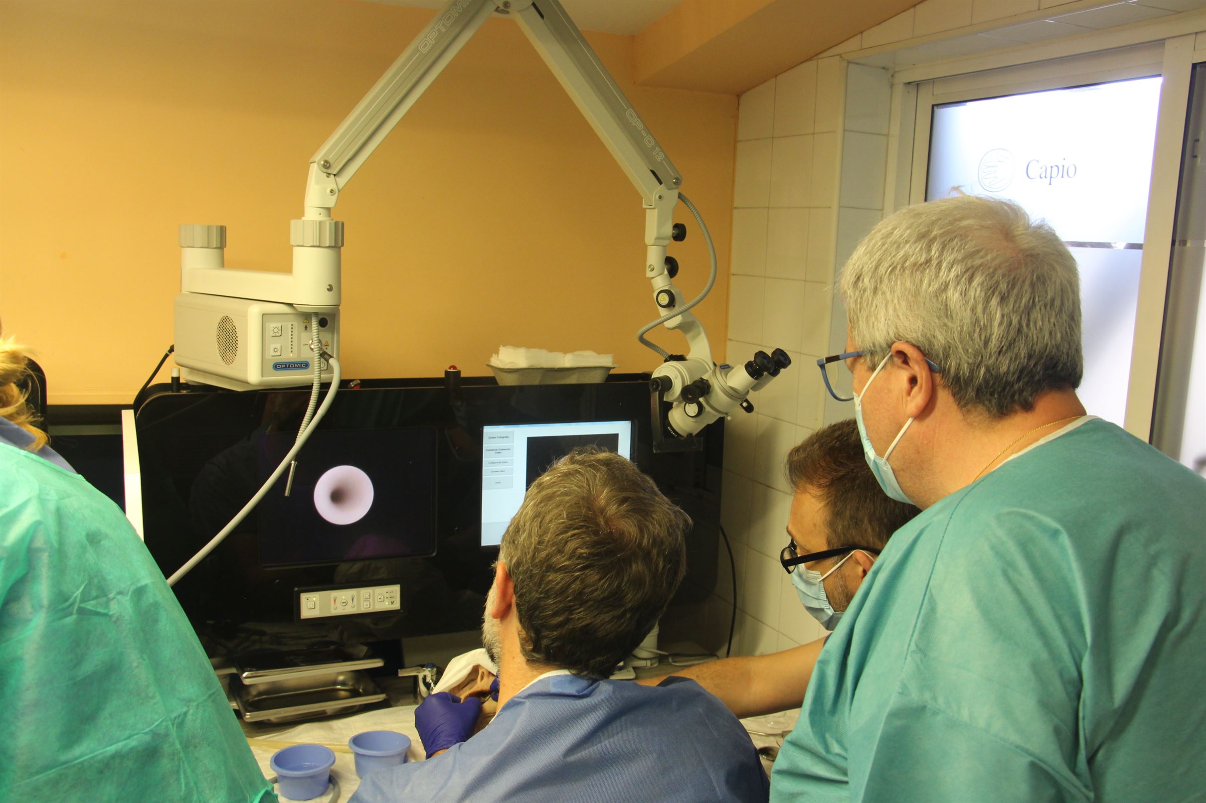Sialoendoscopia 3 nuevo